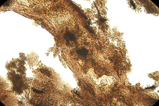 through_the_microscope